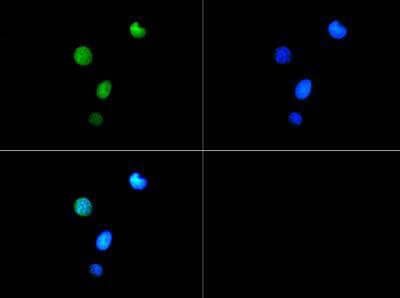 Histone H3 [Trimethyl Lys9, p Thr6] Immunofluorescence