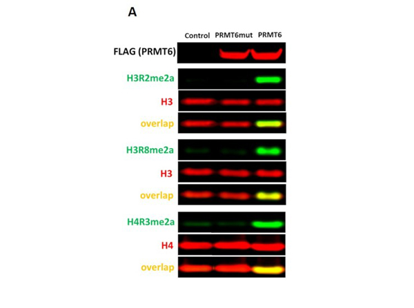 Western Blot using H3R8me2a