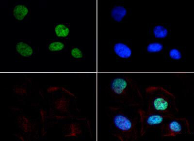 Histone H3 [Dimethyl Lys9] Immunofluorescence