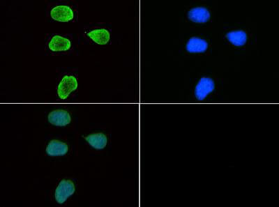 Histone H3 [Trimethyl Lys9] Immunofluorescence