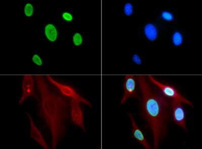 Histone H3 [ac Lys9] Immunofluorescence