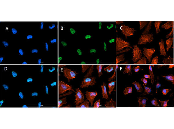 ImmunoFluorescence of Rabbit Anti-Histone H3 K9ac/K14ac Antibody