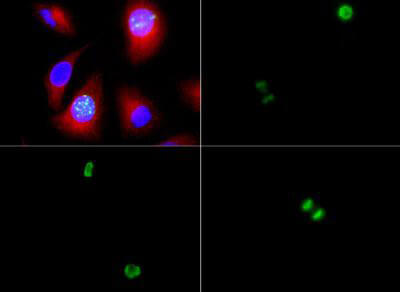 Histone H3 [p Ser10] Immunofluorescence