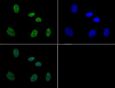 Histone H3 [p Ser10, p Thr11] Immunofluorescence