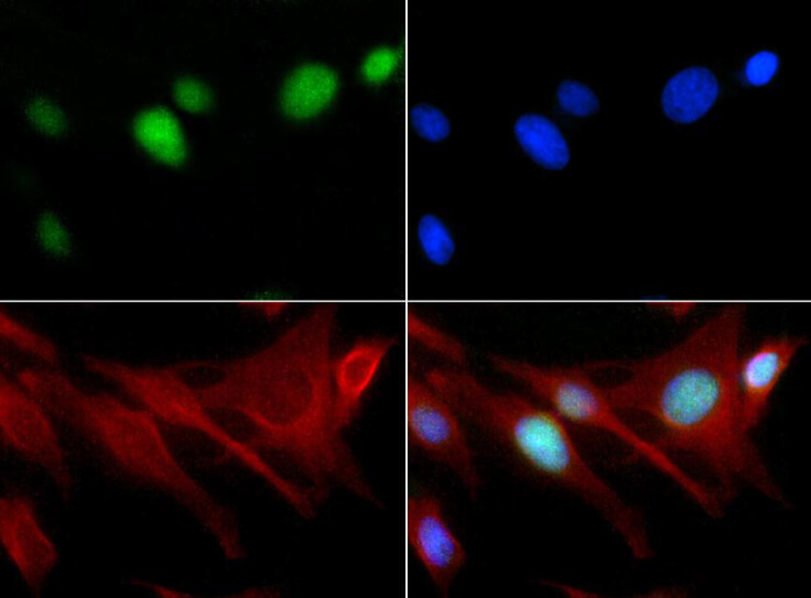 Histone H3 [Monomethyl Lys18] Immunofluorescence