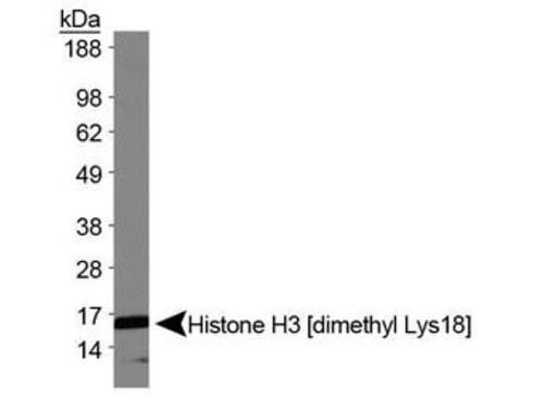 Histone H3 [Dimethyl Lys18] Western Blot