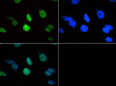 Histone H3 [Trimethyl Lys18] Immunofluorescence