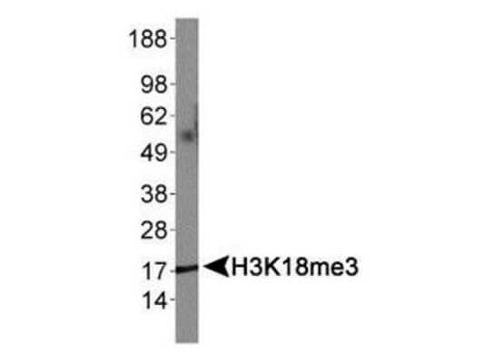Histone H3 [Trimethyl Lys18] Western Blot