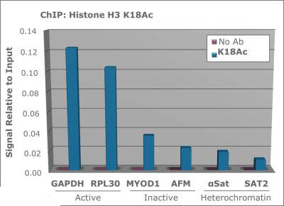 Histone H3 [ac Lys18]  ChIP