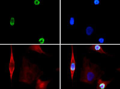 Histone H3 [p Ser28] Immunofluorescence