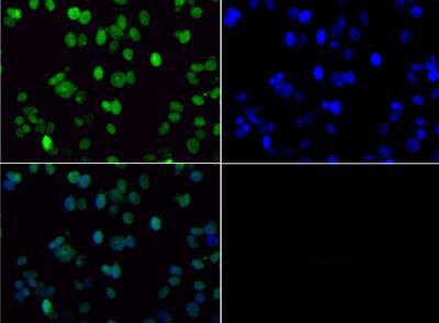 Histone H3 [Dimethyl Lys36] Immunofluorescence