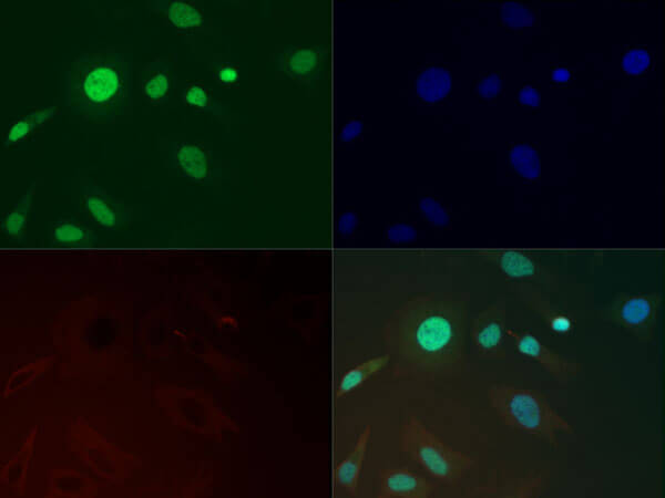 Immunofluorescence of Anti-Histone H3 [Trimethyl Lys36] Antibody