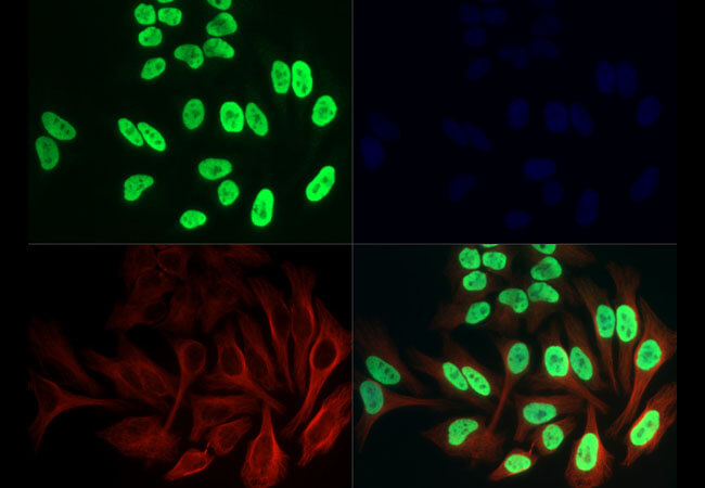 Immunofluorescence of Anti-Histone H3 K36ac