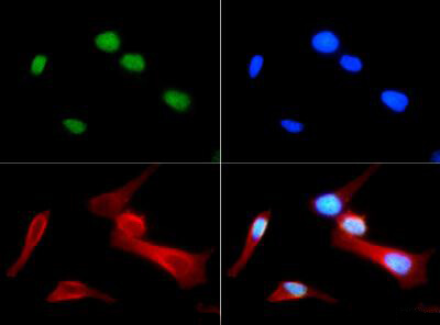 Histone H4 [Monomethyl Arg3] Immunofluorescence