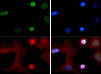 Histone H4 [ac Lys5] Immunofluorescence