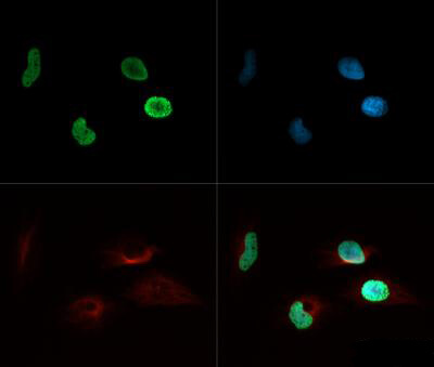 Histone H4 [ac Lys8] Immunofluorescence