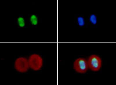 Histone H4 [ac Lys16] Immunofluorescence