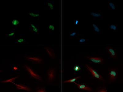 Histone H4 [Monomethyl Lys20] Immunofluorescence