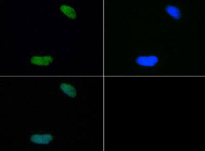 Histone H4 [Dimethyl Lys20] Immunofluorescence