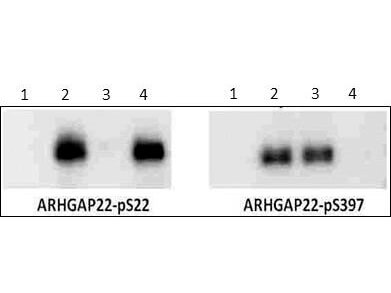 Anti-ARHGAP22 pS397 Western Blot
