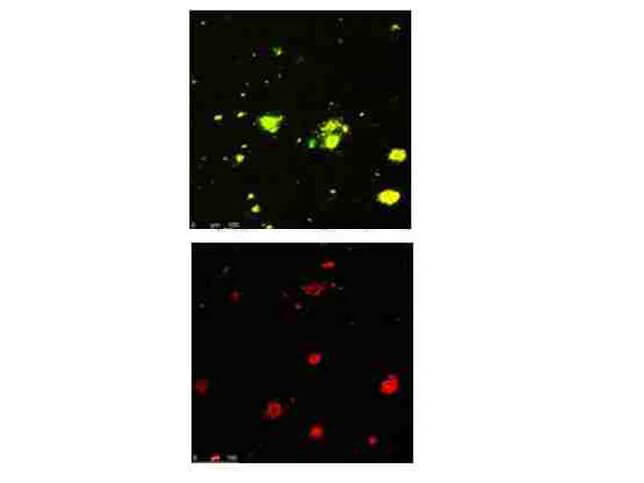 Anti-beta Amyloid pyro E3 Immunofluorescence