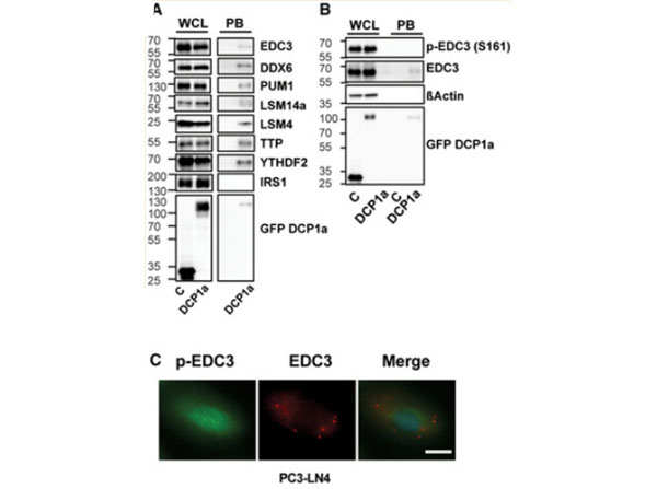 Western Blot and Immunofluorescence of Anti-EDC3 phosho S161 status in P‐bodies