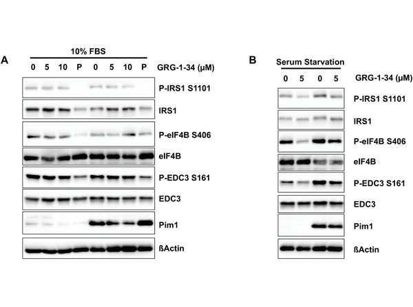 Western Blot using EDC3pS161