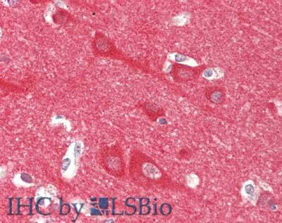 Immunohistochemistry of anti-NCS1 / NCS-1 antibody