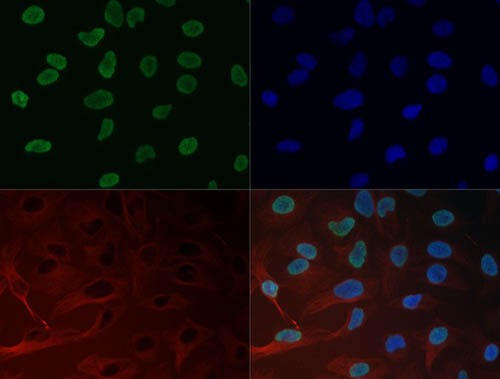 Immunofluorescence of  Histone H3 K27me3 Antibody