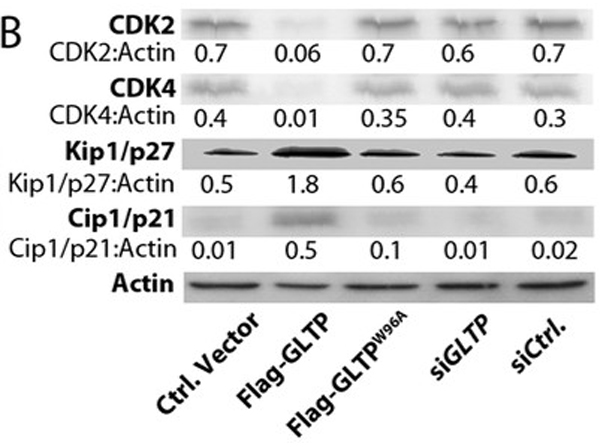 Western Blot using p27kip1 pS140
