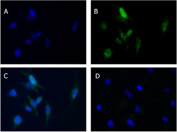 Immunofluorescence of Rabbit Anti-Beclin 1 Antibody