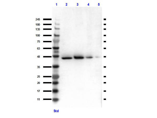 Western Blot of Rabbit Anti-TGF beta Receptor 1 Antibody.