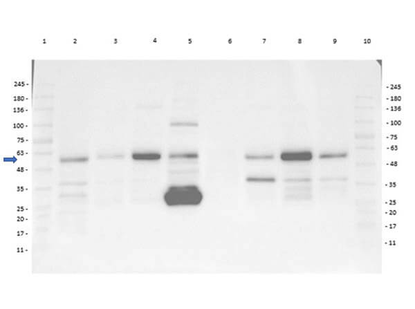 Western Blot of Rabbit Anti-MMP2 Antibody