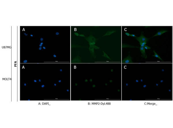 Immunofluorescence of Anti-MMP2 Antibody