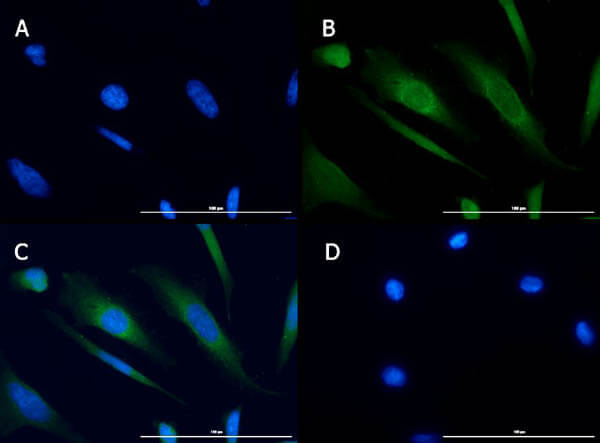 Immunofluorescence of Rabbit Anti-TBK1 Antibody