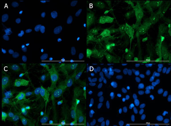 Immunofluorescence of Rabbit Anti-VAChT Antibody