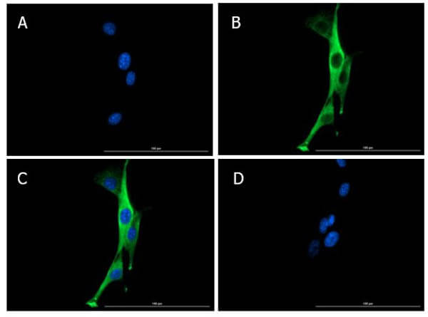 Immunofluorescence of Rabbit Anti-SNAI1 Antibody