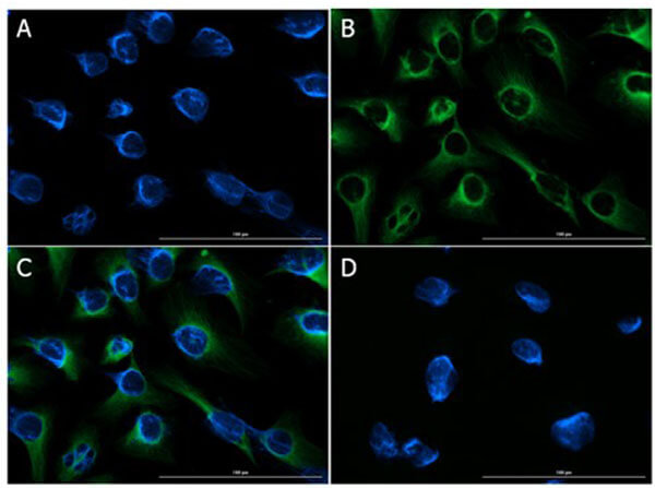 Immunofluorescence of Rabbit Anti-FGFR2 Antibody