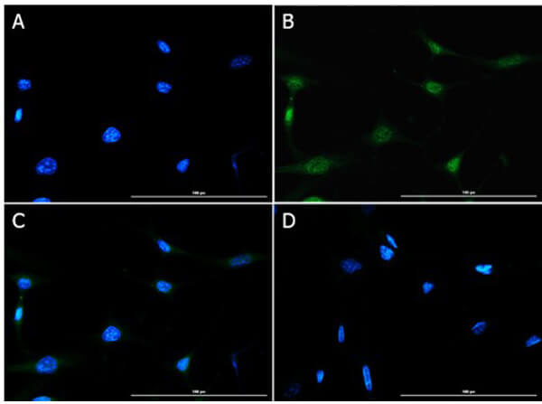 Immunofluorescence of Rabbit Anti-Foxp3 Antibody