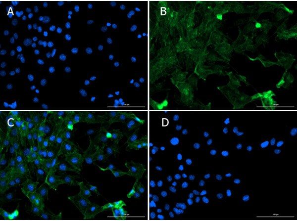 Immunofluorescence of Rabbit Anti-Smad1 Antibody