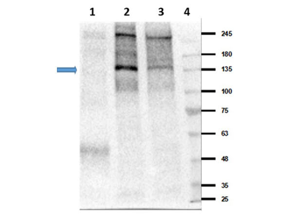 Western Blot of Rabbit Anti-Insulin Receptor pY 1361 Antibody