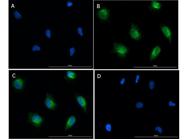 Immunofluorescence of Rabbit Anti-SMAD2pS467 Antibody