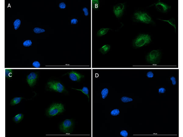 Immunofluorescence of Rb Anti-SMAD2 pS467 Antibody