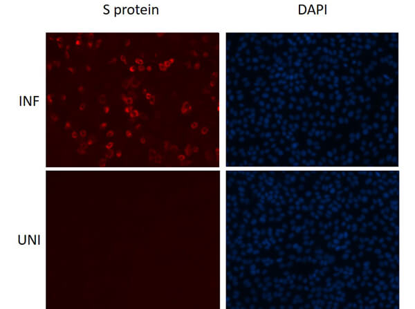 Immunofluorescence assay using Rabbit Anti-SARS-CoV-2 Spike Protein (RBD) Antibody