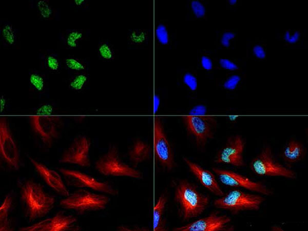 Immunofluorescence of Rabbit Histone H3 pT3/R2Me2s
