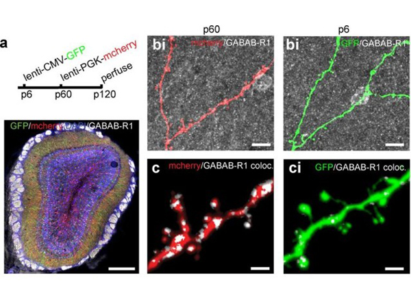 Immunofluorescence using mCherry