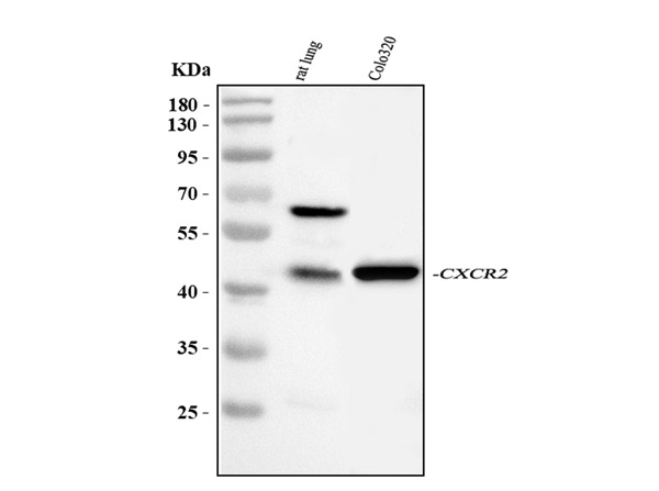 Western blot analysis of CXCR2