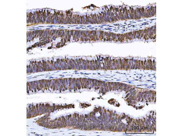 Immunohistochemistry analysis of GSTP1