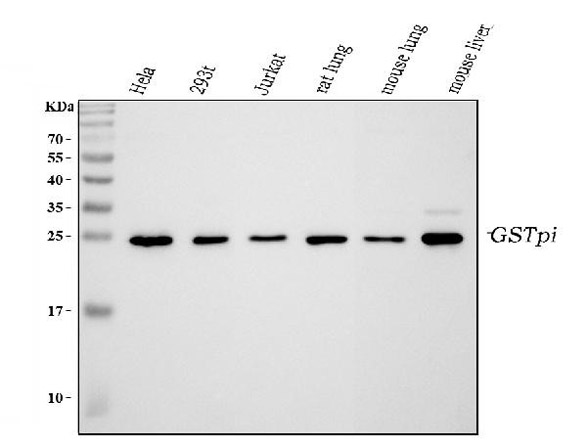 Western Blot analysis of GSTP1