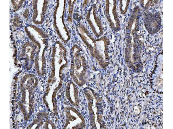 Immunohistochemistry analysis of GSTP1